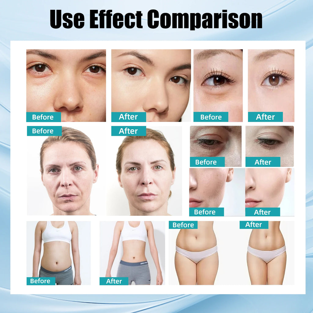 Professional Anti-Aging Beauty Device, 4-in-1 with RF Ultrasound & EMS for Facial Lifting, Wrinkle Reduction, Body Care