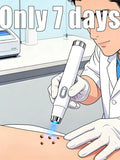 Wart Remover Blue Light Therapy Device | Easy to Clean Portable Skin Care Tool for Wart & Skin Tag Removal, Home Use